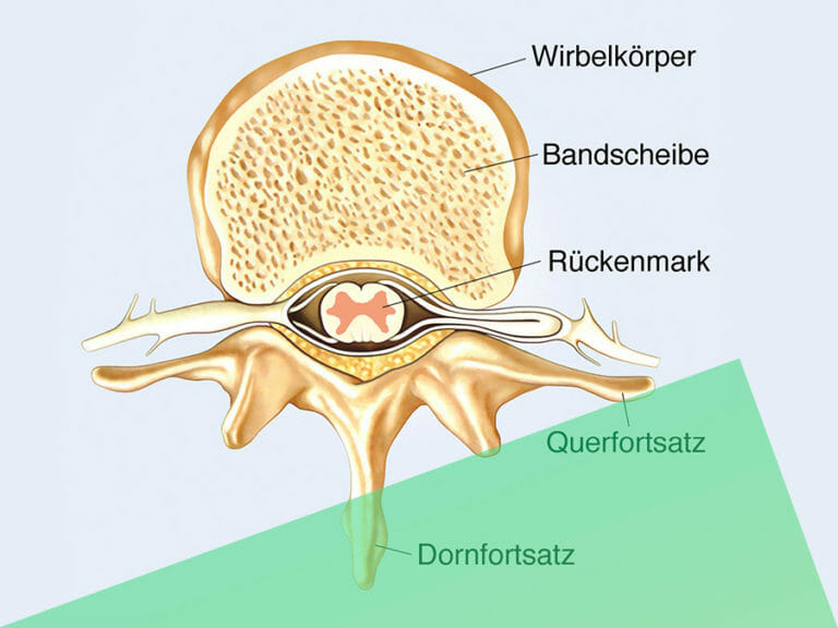 Bandscheiben fit halten Bandscheibe BasisInfo